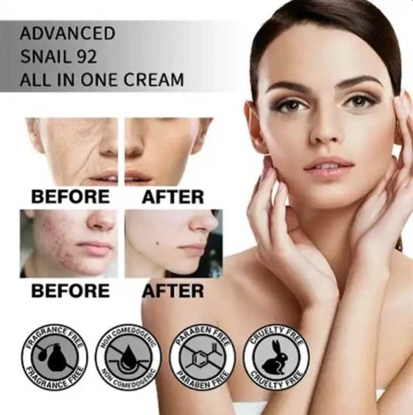 کرم مرطوب کننده و تغذیه کننده حلزون کوزارکس Cosrx کاسه ای 100 گرم