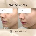 سرم آبرسان هیالورونیک و pdrn آنوا 30 میلی لیتر